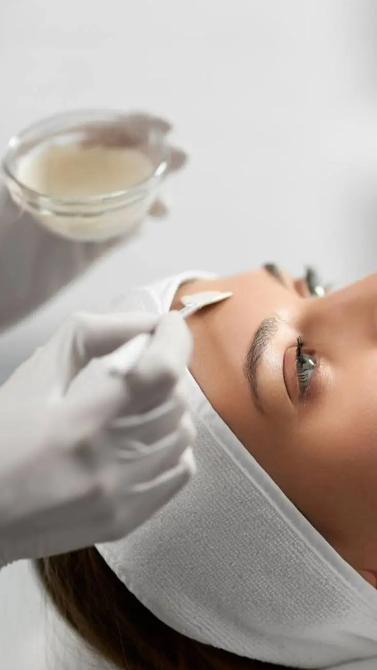 Aplicación profesional de peeling químico